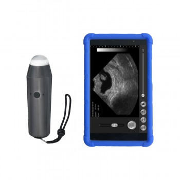 S3 Full Digital WIFI Wireless Handheld Vet Ultrasound Scanner Portable Ultrasoni...